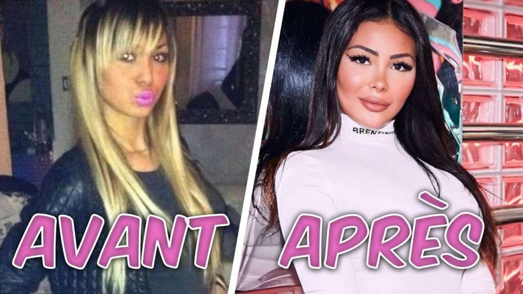 Maeva Ghennam et la chirurgie esthétique