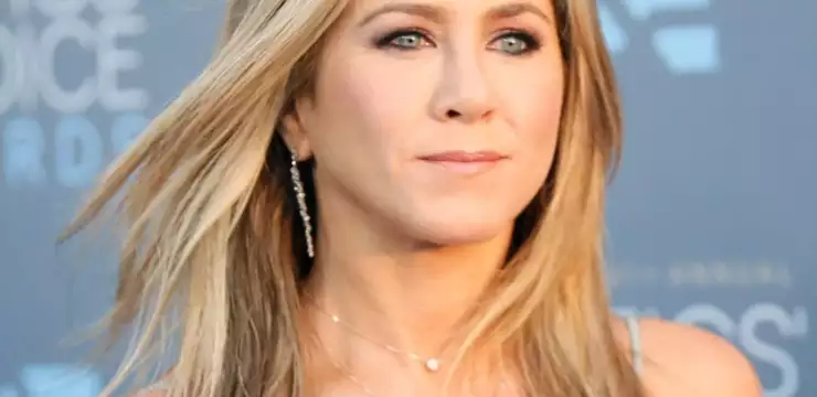 Jennifer Aniston et la chirurgie esthétique