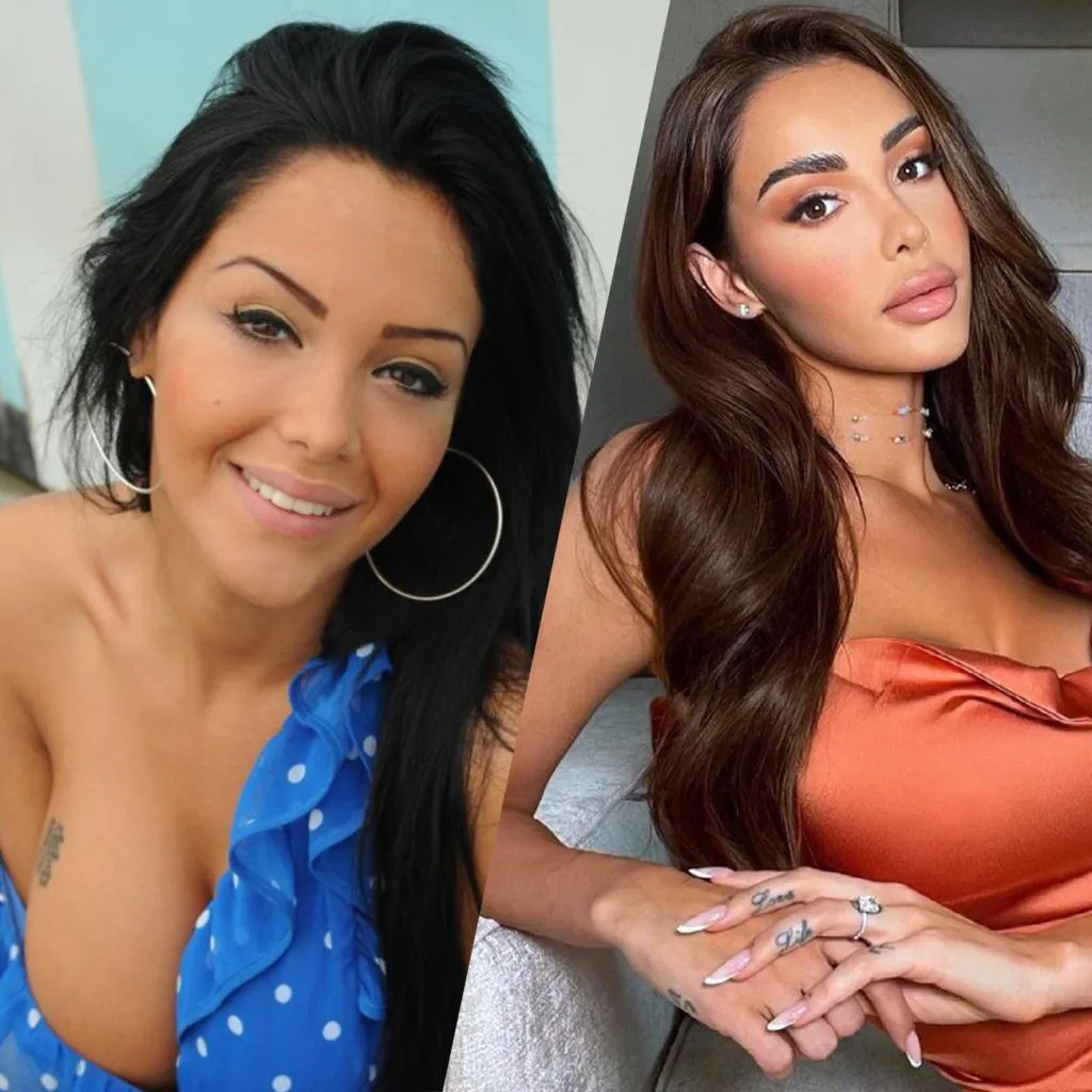 Nabilla avant/après la chirurgie esthétique