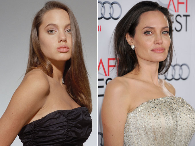 Rhinoplastie Angelina Jolie avant après 