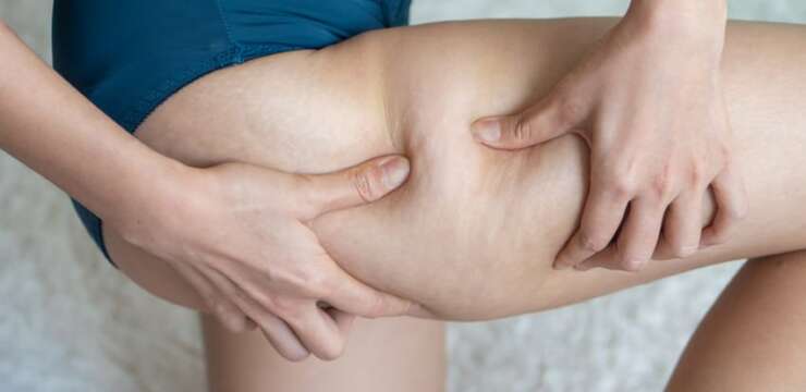 Liposuccion des cuisses Tunisie