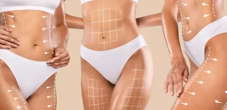 BBL et une Abdominoplastie